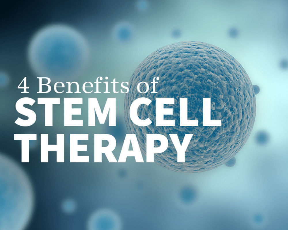 Stem cell Therapy